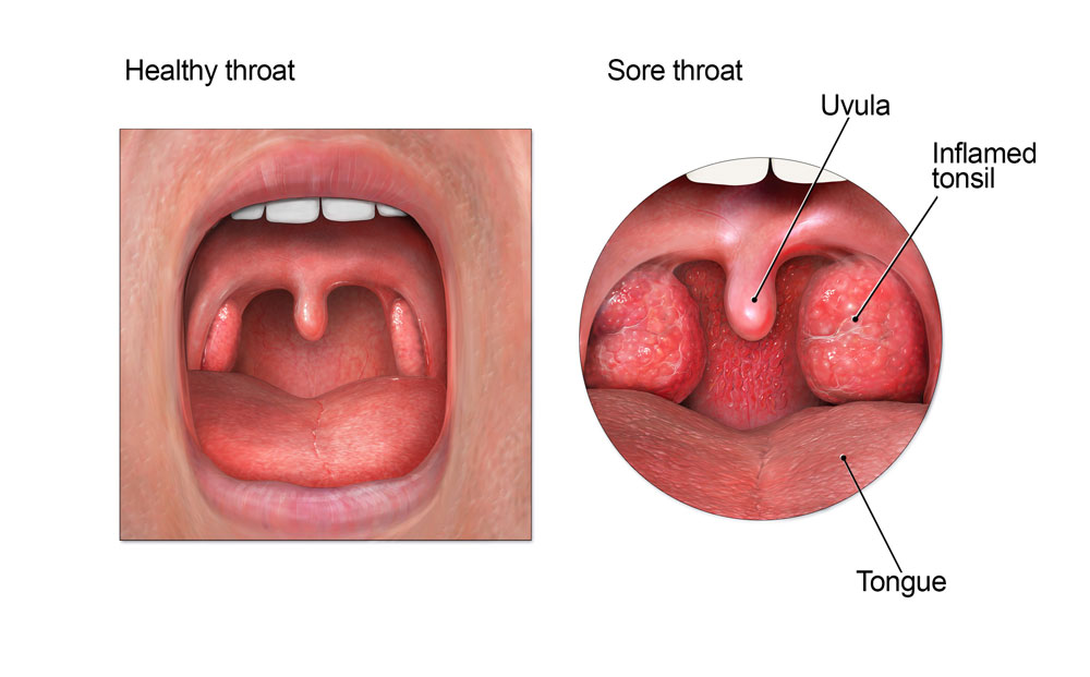 how long does a sore throat last